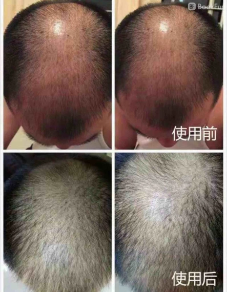 professional 養髮頭部預衰療愈療程 - 頭道湯養生館 (中環店) - 按摩 in 香港島 | BookFun