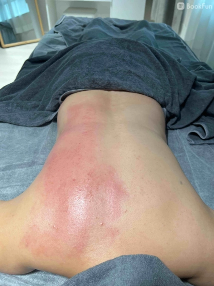 quality 韓國溫宂背脊鬆筋療程 - Apple Beauty Origin - 美容 in 九龍 | BookFun