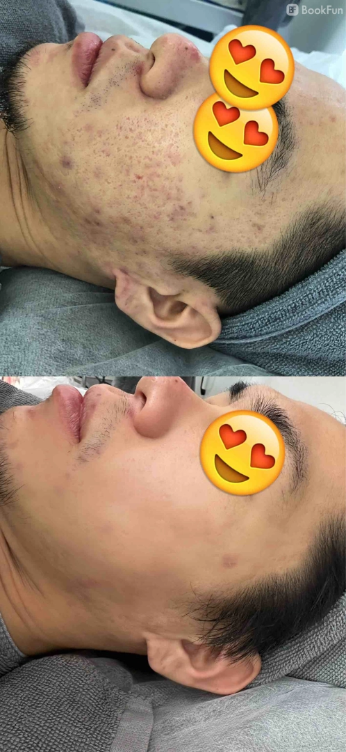 優質 九龍 美容 | Apple Beauty Origin - 專業服務 | BookFun