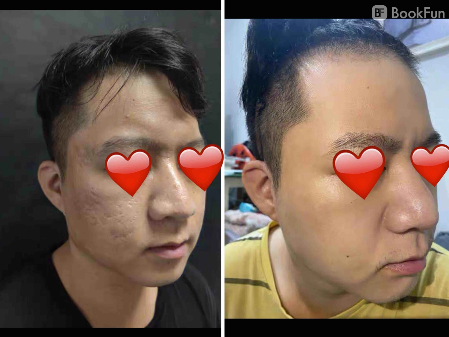 優質 九龍 美容 | Apple Beauty Origin - 專業服務 | BookFun