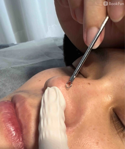 優質 九龍 美容 - 男士陶瓷肌暗瘡護理 - Apple Beauty Origin | BookFun