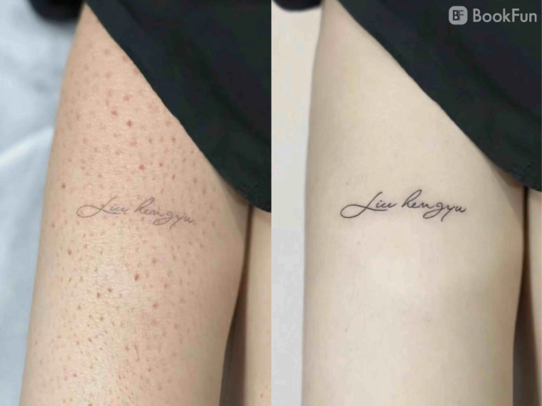 quality 陶瓷肌 身體（改善暗瘡，暗瘡印、毛囊堵塞） - Apple Beauty Origin - 美容 in 九龍 | BookFun