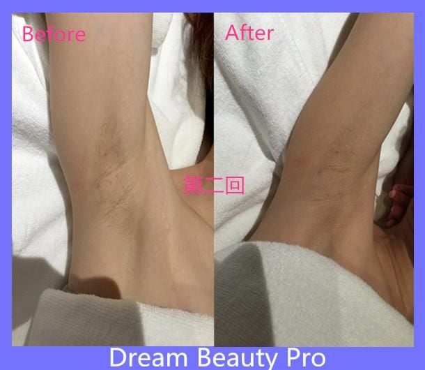 Dream Beauty Pro (旺角VIP店)