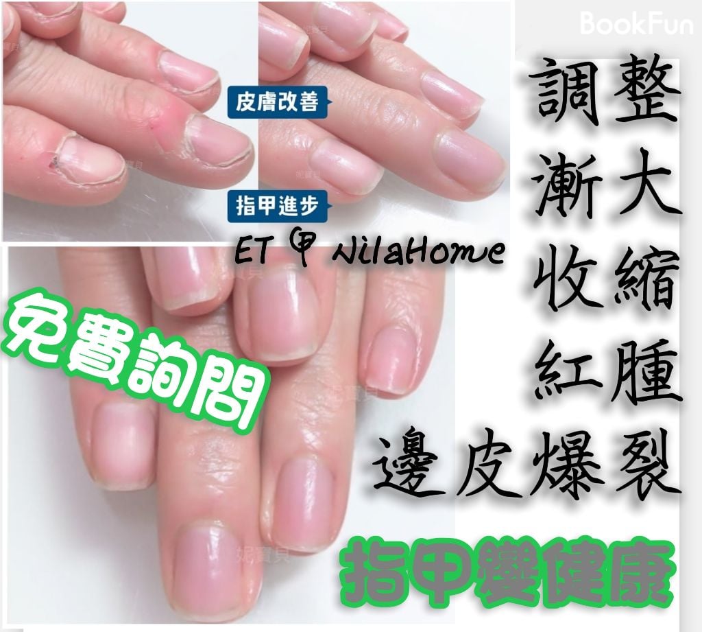 #美甲店ET甲NailHOME調整甲型QQ甲《#牛頭角觀塘Wts51196951美甲店ET甲NailHOME》