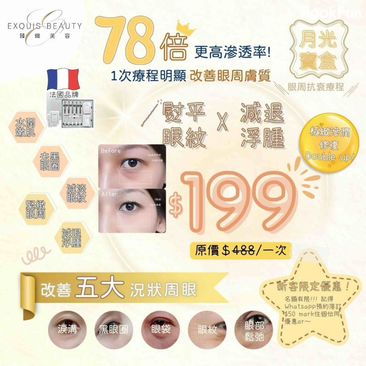 Exquis Beauty 最新推出眼部修復再生療程 ，使用🇫🇷法國專業品牌產品，極細份子超易被眼周吸收，比一般產品高出78倍滲度率結合我哋獨家眼部按摩方法結合專業儀器導入，為眼周肌底打開通道，將濃縮精華全面滲潤每一粒細胞，粒粒細胞吸飽養份，眼周肉眼可見更緊緻飽滿，去黑眼圈同時減退浮腫；無論你係天生或後天眼周問題，月光寶盒眼周修復療程都可以全面解決你嘅煩惱

🌙月光寶盒眼部修復療程
✅祛眼紋 
✅去黑眼圈 
✅減退眼部浮腫 
✅提升眼部輪廓  
✅眼周水潤彈性 
✅重塑緊緻飽滿眼周肌膚 
