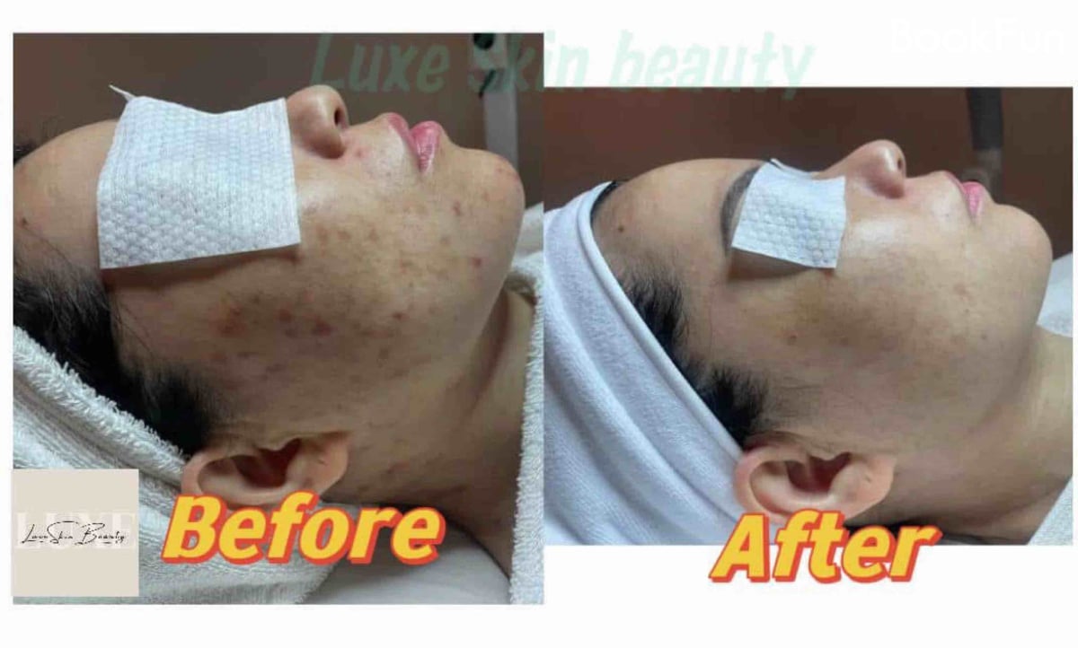 優質 九龍 美容 | 優悅美肌中心 - 專業服務 | BookFun