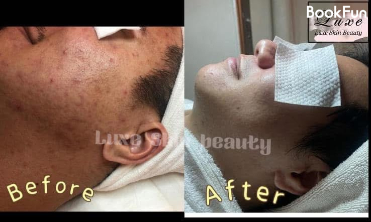 優質 九龍 美容 | 優悅美肌中心 - 專業服務 | BookFun