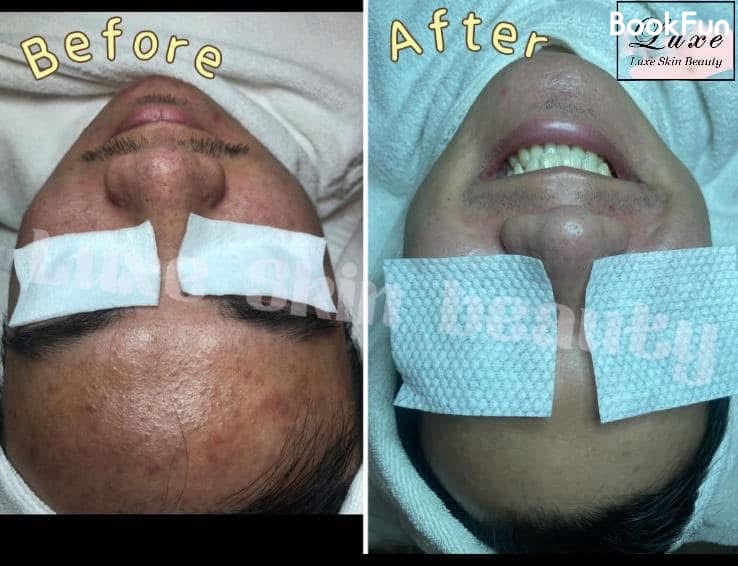 優質 九龍 美容 | 優悅美肌中心 - 專業服務 | BookFun